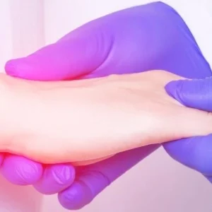 اسپوندیلیت انکیلوزان