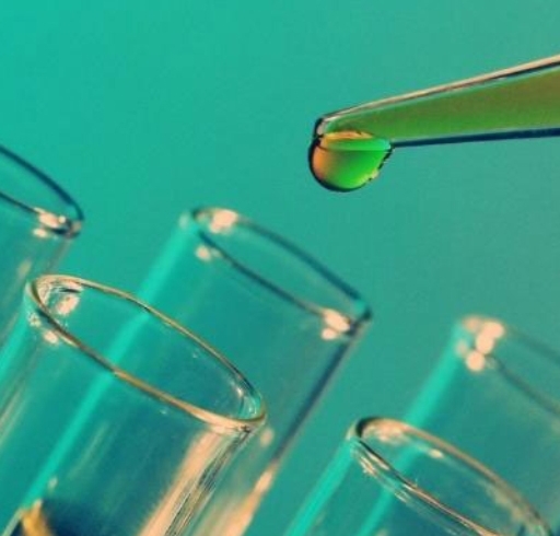 آنالیز مایع مفصلی (سینوویال) چیست؟ | Synovial Fluid Analysis