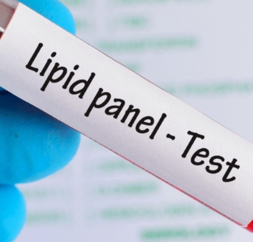 آزمایش های چربی خون | Lipid Panel