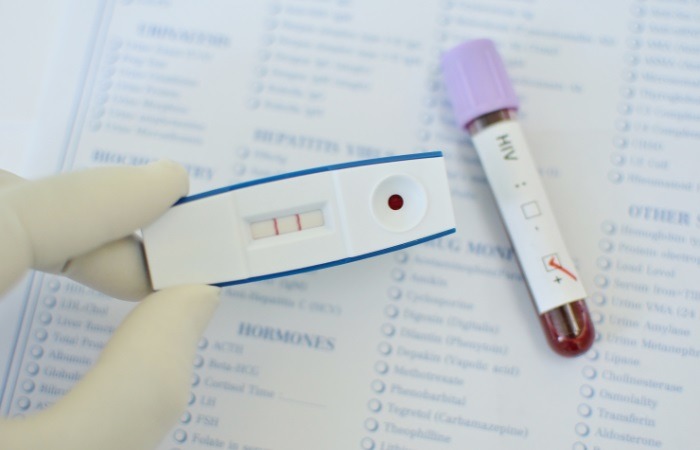 تست تشخیص خانگی اچ آی وی