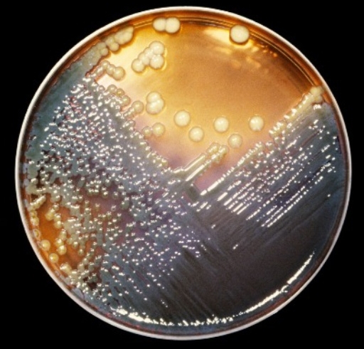 آزمایش های کشت باکتریایی | Bacterial Culture Tests