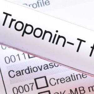 آزمایش تروپونین | Troponin Test