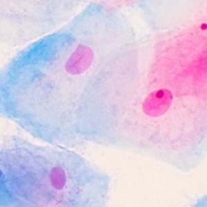 پاپ اسمیر | Pap Smear