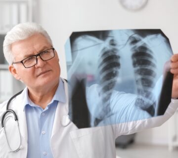 تخصص ریه و دستگاه تنفسی