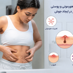 علت جوش روی شکم زنان؛ از تغییرات هورمونی تا بیماری‌های پوستی که نباید نادیده گرفت